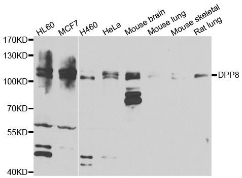 Western blot - DPP8 antibody (144-07113)