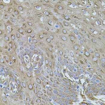 Immunohistochemistry - FLNB Polyclonal Antibody (144-02481)