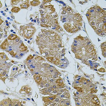 Immunohistochemistry - TEFM Polyclonal Antibody (144-08511)