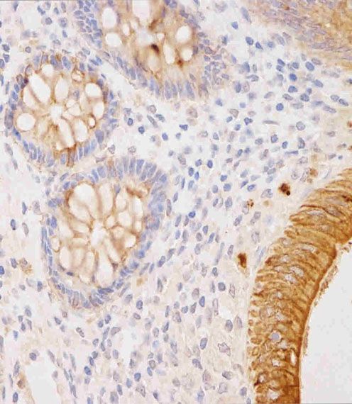 IHC