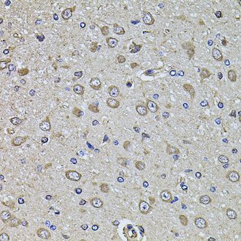 Immunohistochemistry - EPHA3 antibody (144-08414)