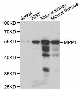 Western blot - MPP1 antibody (144-06298)