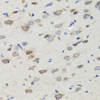 Immunohistochemistry - SIAH1 antibody (144-02494)