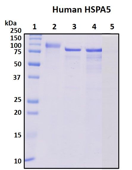 SDS-PAGE