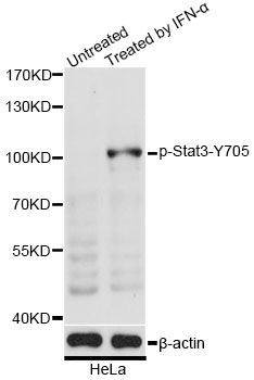 Western blot - Phospho-Stat3-Y705 pAb (144-50070)