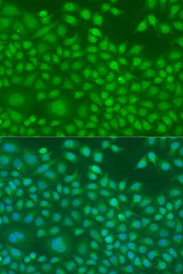 Immunofluorescence - NIN antibody (144-08215)