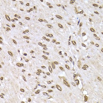 Immunohistochemistry - LMNB2 Polyclonal Antibody (144-06483)