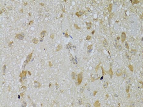 Immunohistochemistry - TSHR Polyclonal Antibody (144-06781)