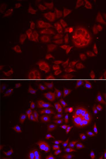 Immunofluorescence - SPINT1 antibody (144-06411)