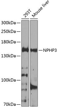 Western blot
