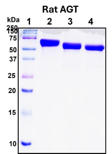 SDS-PAGE Image