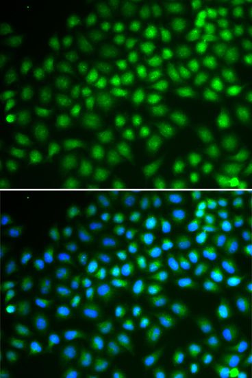 Immunofluorescence - SMARCA5 antibody (144-02000)