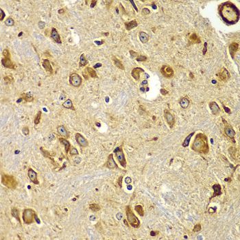Immunohistochemistry - SMAD9 antibody (144-07518)