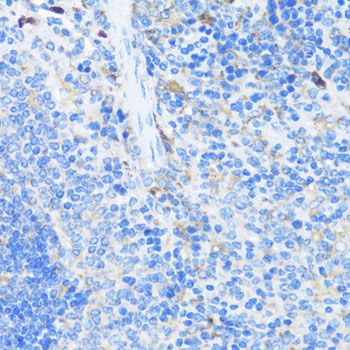 Immunohistochemistry - EIF3J Polyclonal Antibody (144-08637)