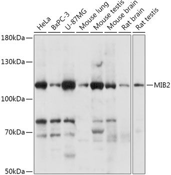 Western blot