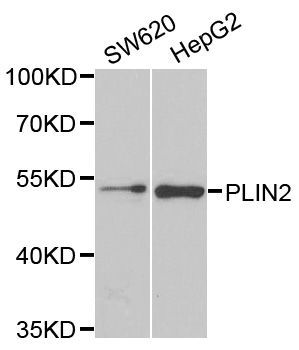 Western blot - PLIN2 Polyclonal Antibody (144-06276)