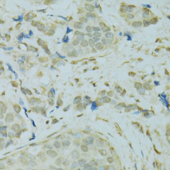 Immunohistochemistry - SAFB antibody (144-07927)