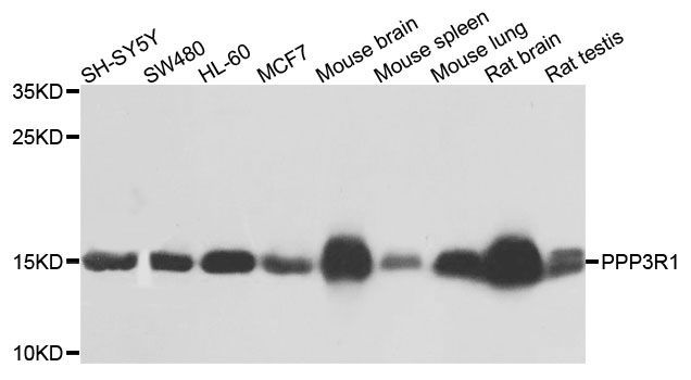 Western blot - PPP3R1 Polyclonal Antibody (144-00954)