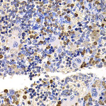 Immunohistochemistry - UBE2V2 Polyclonal Antibody (144-06998)
