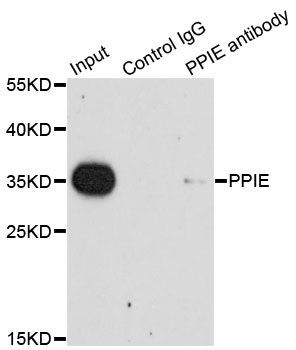 Immunoprecipitation - 1ug PPIE antibody (144-07061)