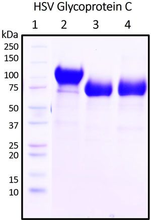SDS-PAGE