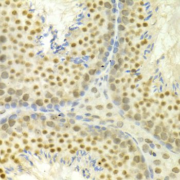 Immunohistochemistry - MAPK3 Polyclonal Antibody (144-00228)