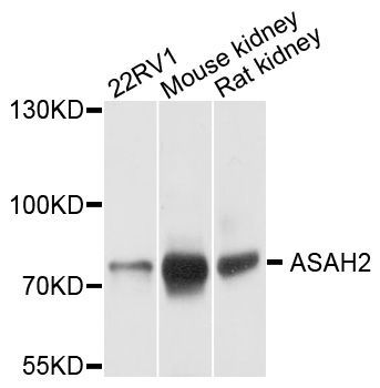 Western blot - ASAH2 antibody (144-12596)