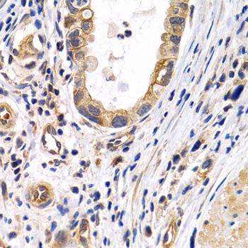 Immunohistochemistry - PTGIR Polyclonal Antibody (144-01849)