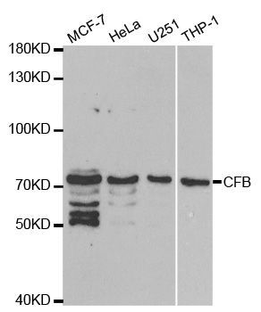 Western blot - CFB antibody (144-01706)