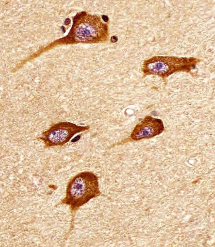 IHC-P