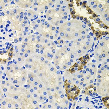 Western blot - CALB2 Polyclonal Antibody (144-09807)