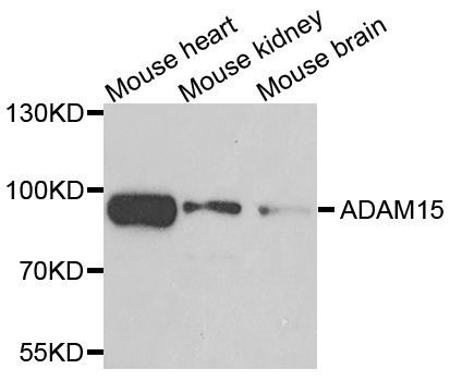 Western blot - ADAM15 antibody (144-07756)