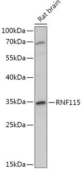 Western blot