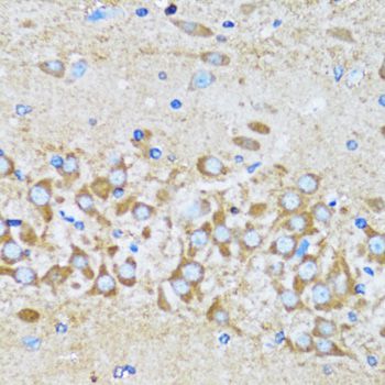 Immunohistochemistry - ACTR2 Polyclonal Antibody (144-05734)