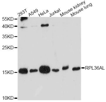 Western blot - RPL36AL antibody (144-60650)