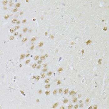 Immunohistochemistry - SNRPA Antibody (144-06410)