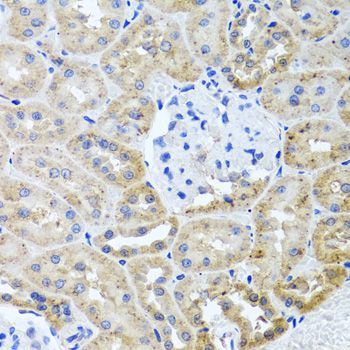 Immunohistochemistry - HDAC6 antibody (144-01732)