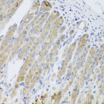 Immunohistochemistry - RARS2 antibody (144-08503)