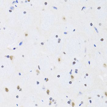 Immunohistochemistry - PRPF19 antibody (144-06706)