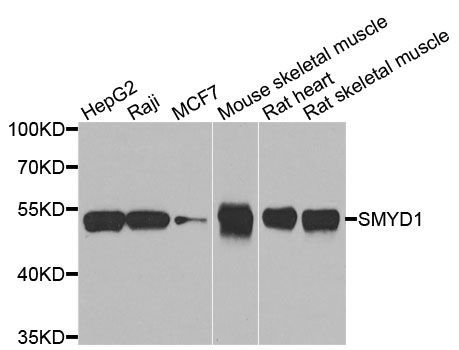 Western blot - SMYD1 antibody (144-07308)