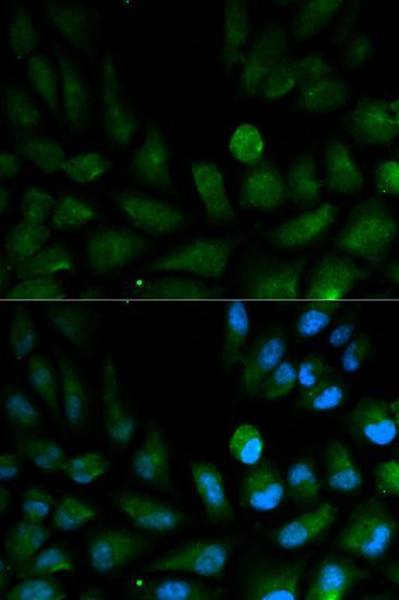 Immunofluorescence - CAPZA2 antibody (144-02054)