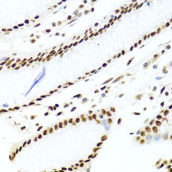 Immunohistochemistry - SSB Polyclonal Antibody (144-00630)