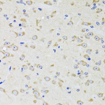 Western blot - YWHAZ Polyclonal Antibody (144-07639)