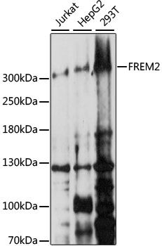Western blot - FREM2 antibody (144-61307)