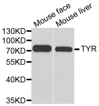 Western blot - TYR Polyclonal Antibody (144-01254)