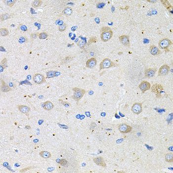 Immunohistochemistry - GNE Polyclonal Antibody (144-08570)