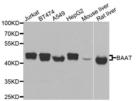 Western blot - BAAT Polyclonal Antibody (144-07646)