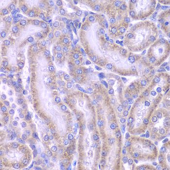 Immunohistochemistry - ACAA1 antibody (144-07422)