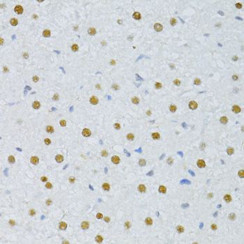 Immunohistochemistry - SNRNP70 antibody (144-06065)