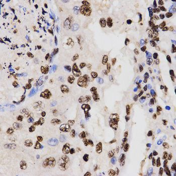 Immunohistochemistry - DiMethyl-Histone H3-K27 pAb (144-02362)